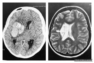 Sam's Thames Path Challenge